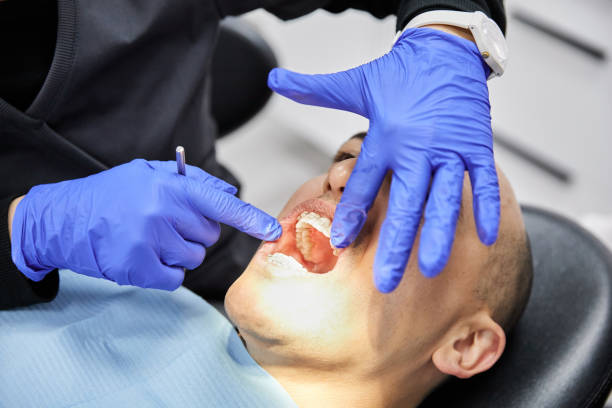 Best Teeth Whitening  in Flint, MI