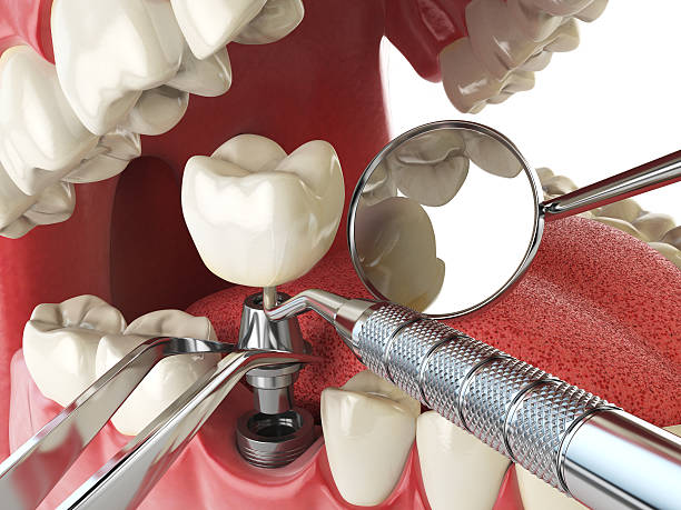 Best Urgent Tooth Repair  in Flint, MI